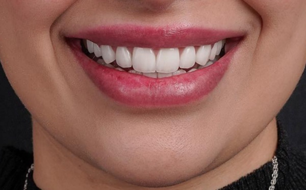 Complete Smile Makeover: Achieve Your Dream Smile With General Dentistry