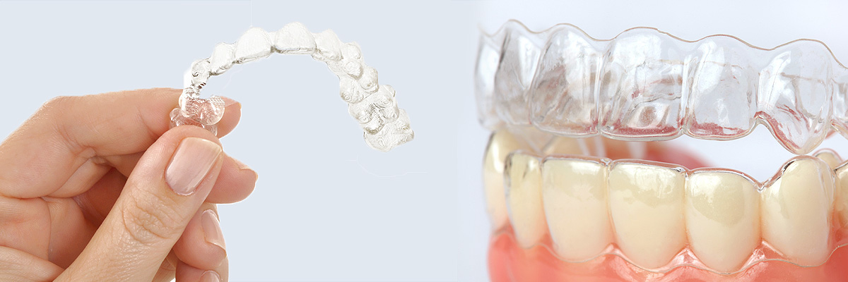 Delray Beach Alternative to Braces for Teens