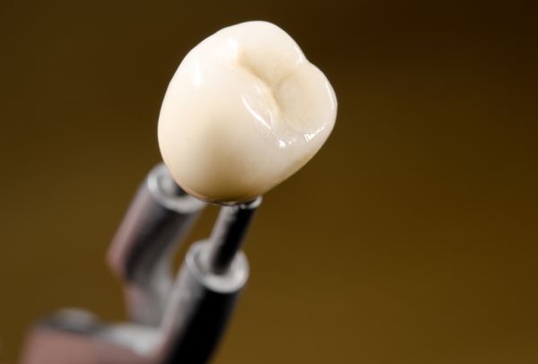 Tips To Preserve Your Ceramic Crowns [Dental Restoration]