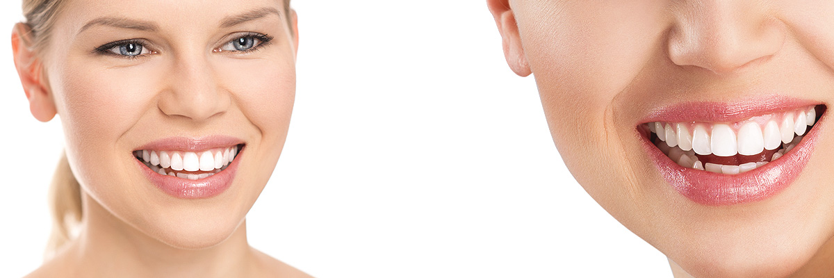 Delray Beach Cosmetic Dental Services