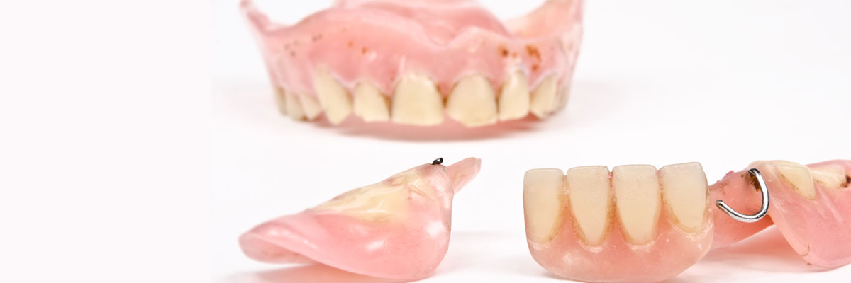 Delray Beach What Do I Do If I Damage My Dentures?