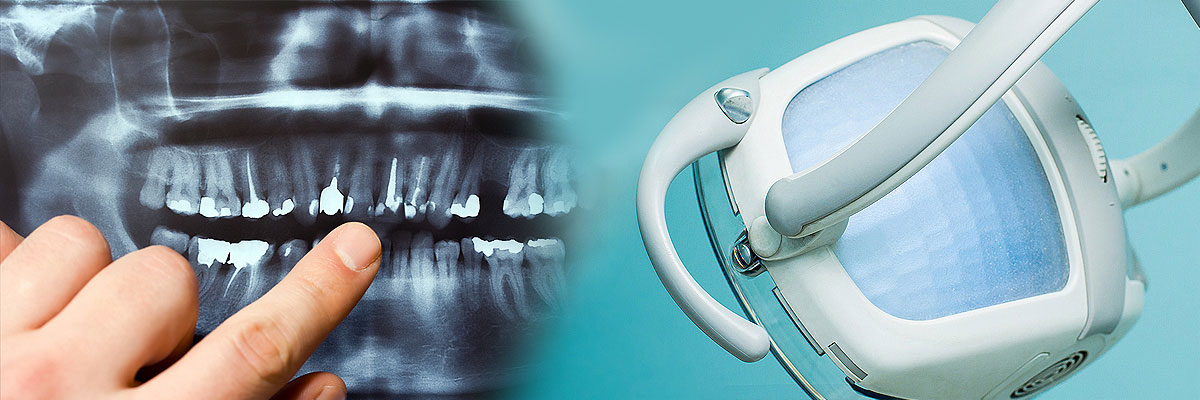 Delray Beach Dental Cleaning