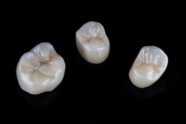 A Comparison Of Dental Crown Materials