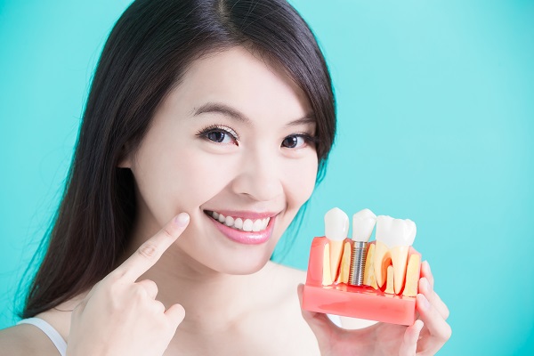 Implant Crown: The Final Step In Restoring Your Smile