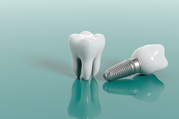 Securely Replace Missing Teeth With Dental Implants