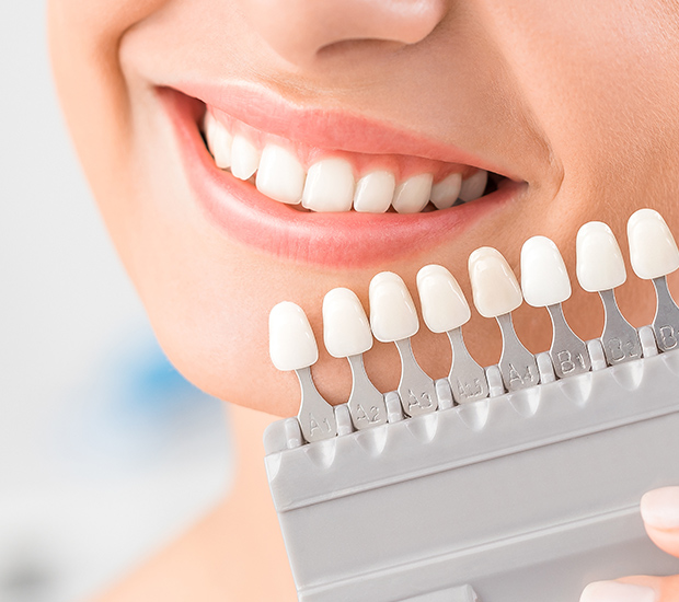 Delray Beach Dental Veneers and Dental Laminates