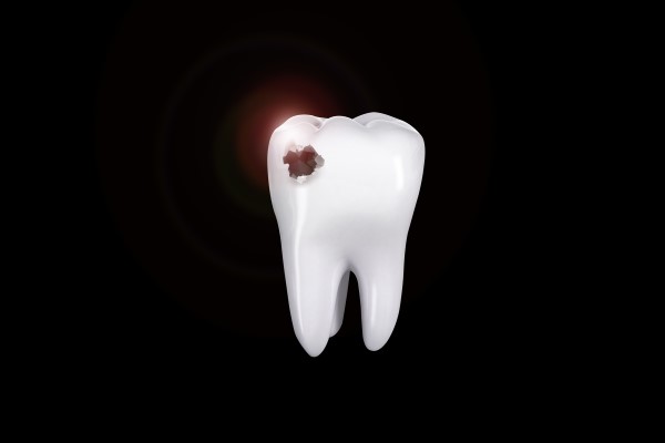 Infected Tooth Relief From An Emergency Dentist