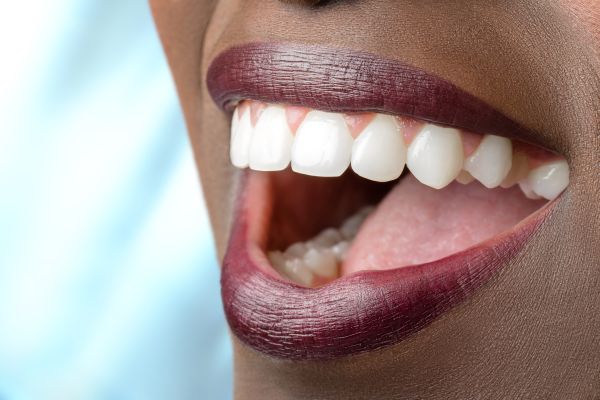 Reasons To Consider A Full Mouth Reconstruction