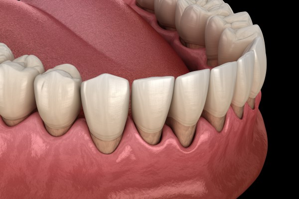 How Gum Disease Is Treated By Your Dentist