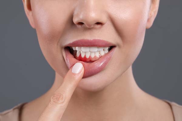 Types Of Treatment For Gum Disease