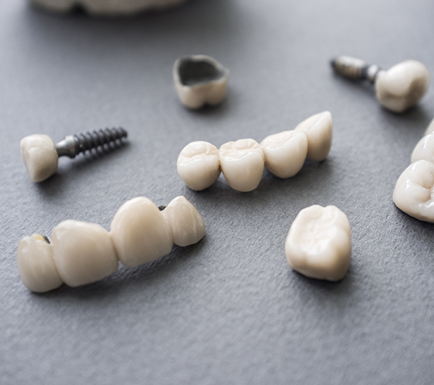Delray Beach The Difference Between Dental Implants and Mini Dental Implants
