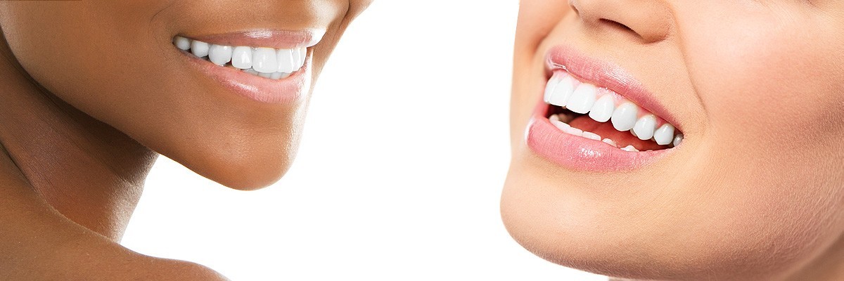 Delray Beach Improve Your Smile for Senior Pictures