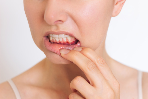 Periodontics: Protecting The Gums For A Healthier Smile