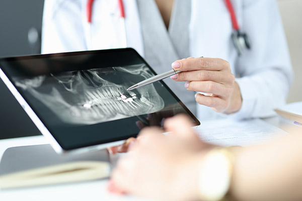 The Importance of Regular Dental Checkup X-Rays from Palm Beach Dentistry in Delray Beach, FL