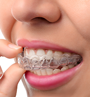 Clear Aligners - Almost Invisible Braces Delray Beach, FL