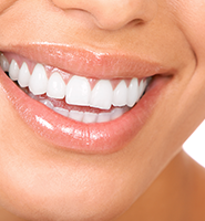 Teeth Whitening Services Delray Beach, FL