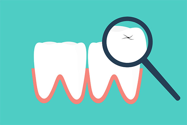 Four Tips for Making Your Dental Crowns Last from Palm Beach Dentistry in Delray Beach, FL