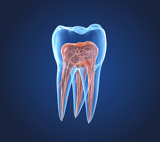 Delray Beach What is an Endodontist